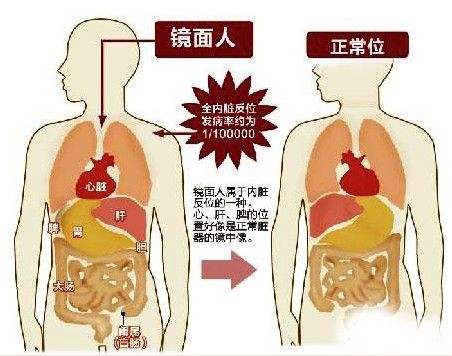 镜像示意图.jpg 镜像示意图.jpg